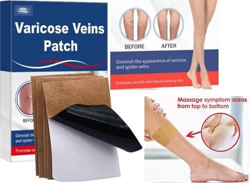 Royal prestige varicose veins patch 2 Pack
